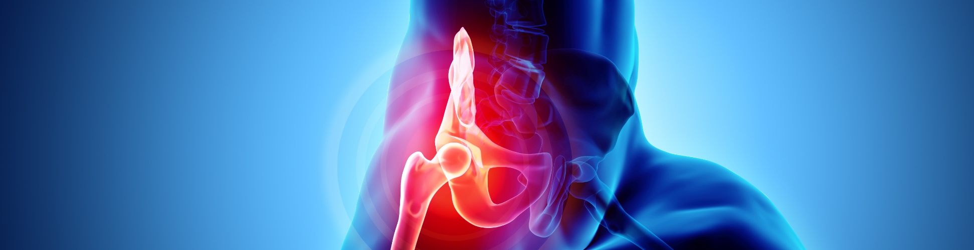 Hip Pain Relief